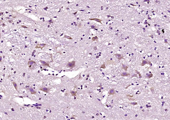 PXMP4 Rabbit Polyclonal Antibody