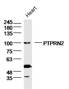 PTPRN2 Rabbit Polyclonal Antibody