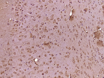 QIL1/C19orf70 Rabbit Polyclonal Antibody