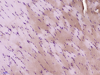 OBSCN Rabbit Polyclonal Antibody