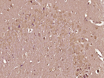 RALGAPB/p170 Rabbit Polyclonal Antibody