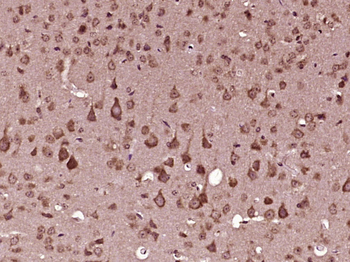 RAPGEFL1 Rabbit Polyclonal Antibody