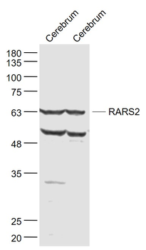 RARS2 Rabbit Polyclonal Antibody