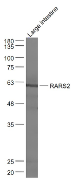 RARS2 Rabbit Polyclonal Antibody