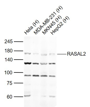 RASAL2 Rabbit Polyclonal Antibody
