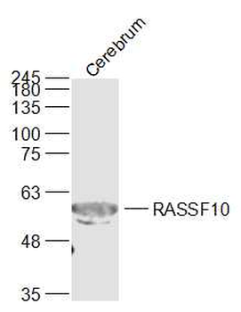 RASSF10 Rabbit Polyclonal Antibody