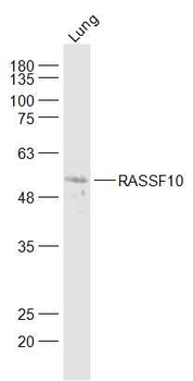 RASSF10 Rabbit Polyclonal Antibody