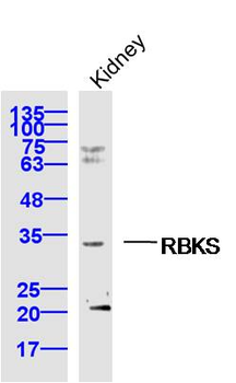 RBKS Rabbit Polyclonal Antibody