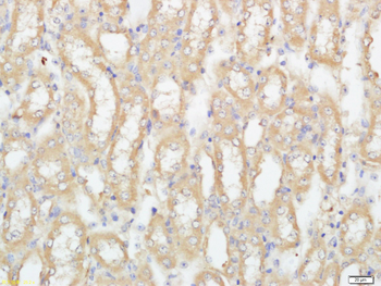 SLC35D2 Rabbit Polyclonal Antibody