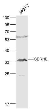 SERHL Rabbit Polyclonal Antibody