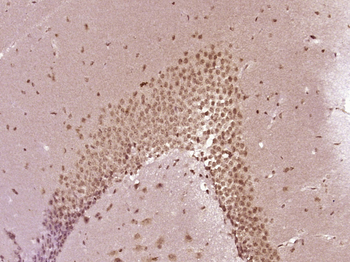 SF3B14 Rabbit Polyclonal Antibody