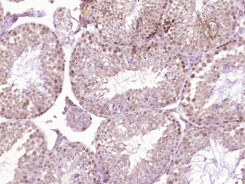 SF3B14 Rabbit Polyclonal Antibody