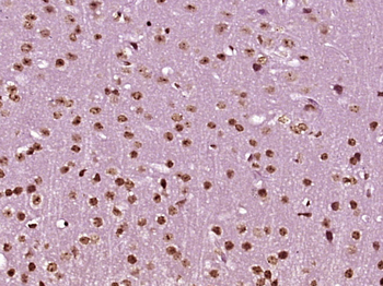 SFRS15 Rabbit Polyclonal Antibody