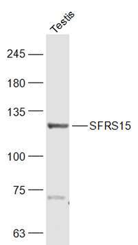 SFRS15 Rabbit Polyclonal Antibody