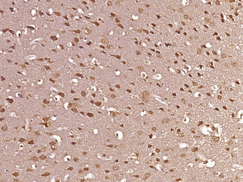 SGTB Rabbit Polyclonal Antibody