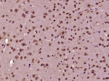 SH2D4B Rabbit Polyclonal Antibody