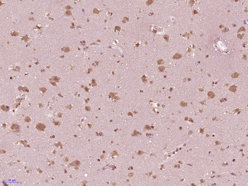 SH2D7 Rabbit Polyclonal Antibody