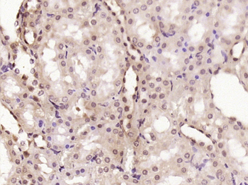 SH3D19 Rabbit Polyclonal Antibody