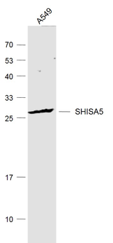 SHISA5 Rabbit Polyclonal Antibody
