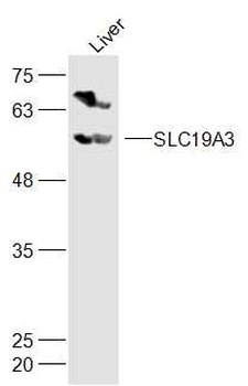 SLC19A3 Rabbit Polyclonal Antibody