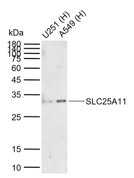 SLC25A11 Rabbit Polyclonal Antibody