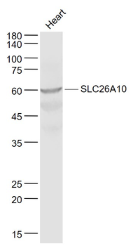 SLC26A10 Rabbit Polyclonal Antibody