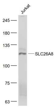 SLC26A8 Rabbit Polyclonal Antibody