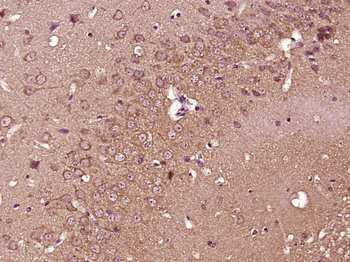 SLC36A2 Rabbit Polyclonal Antibody