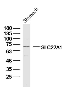 SLC22A1 Rabbit Polyclonal Antibody