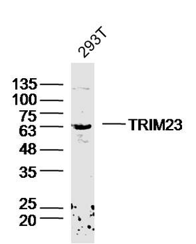 TRIM23 Rabbit Polyclonal Antibody