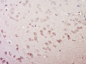 VGLUT3/SLC17A8 Rabbit Polyclonal Antibody