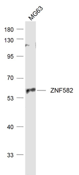 ZNF582 Rabbit Polyclonal Antibody