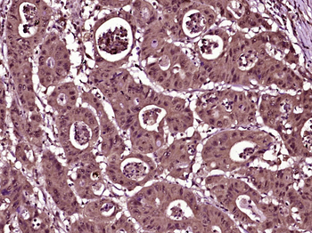 ZNF583 Rabbit Polyclonal Antibody
