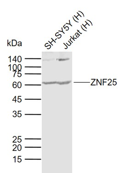 ZNF25 Rabbit Polyclonal Antibody