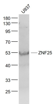 ZNF25 Rabbit Polyclonal Antibody