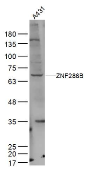 ZNF286B Rabbit Polyclonal Antibody