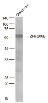 ZNF286B Rabbit Polyclonal Antibody