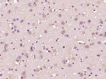 ZNF775 Rabbit Polyclonal Antibody