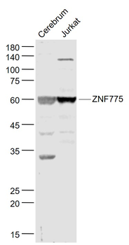 ZNF775 Rabbit Polyclonal Antibody