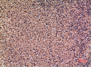 IL-28 Rabbit Polyclonal Antibody