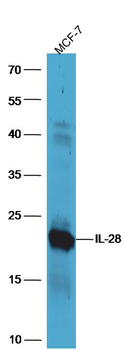 IL-28 Rabbit Polyclonal Antibody