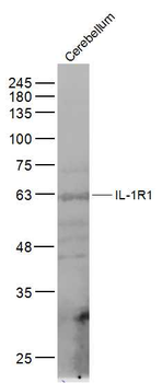 IL-1R1 Rabbit Polyclonal Antibody