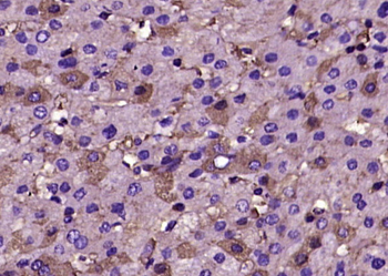 Human Fibrinogen Rabbit Polyclonal Antibody