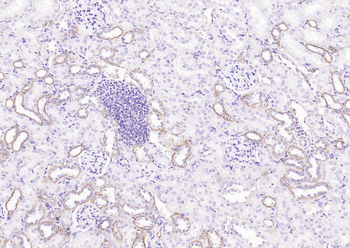 Angiotensin II Type 1 Receptor Rabbit Polyclonal Antibody