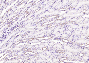 Angiotensin II Type 1 Receptor Rabbit Polyclonal Antibody