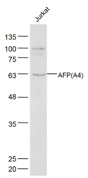 AFP (A4) Mouse Monoclonal Antibody
