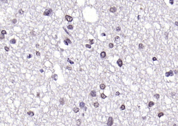 KAT4/TAF1 Rabbit Polyclonal Antibody