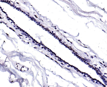 KAT4/TAF1 Rabbit Polyclonal Antibody