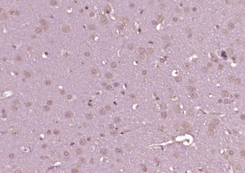 Phospho-c-Abl (Tyr226) Rabbit Polyclonal Antibody