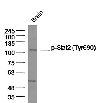 Phospho-Stat2 (Tyr690) Rabbit Polyclonal Antibody
